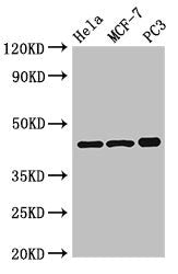 Western Blot Positive WB detected in: Hela whole cell lysate, MCF-7 whole cell lysate, PC-3 whole cell lysate All lanes: PRKAR2A antibody at 2.5µg/ml Secondary Goat polyclonal to rabbit IgG at 1/50000 dilution Predicted band size: 46, 44 kDa Obser...