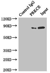 Immunoprecipitating PRKCE in MCF-7 whole cell lysate Lane 1: Rabbit control IgG instead of (1ug) instead of CSB-PA018704ESR2HU in MCF-7 whole cell lysate. For western blotting, a HRP-conjugated anti-rabbit IgG, specific to the non-reduced form of...
