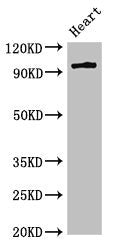 Western Blot Positive WB detected in: Rat heart tissue All lanes: PRKD3 antibody at 3ug/ml Secondary Goat polyclonal to rabbit IgG at 1/50000 dilution Predicted band size: 101, 69 kDa Observed band size: 101 kDa