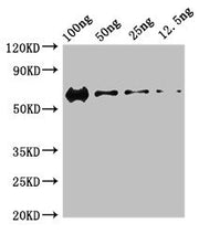 Western Blot Positive WB detected in Recombinant protein All lanes: PRKDC antibody at 3ug/ml Secondary Goat polyclonal to rabbit IgG at 1/50000 dilution predicted band size: 60 kDa observed band size: 60 kDa