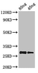 Western Blot Positive WB detected in Recombinant protein All lanes: PRL antibody at 2.8µg/ml Secondary Goat polyclonal to rabbit IgG at 1/50000 dilution predicted band size: 28 kDa observed band size: 28 kDa