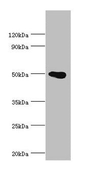 Western blot All lanes: PRMT2 antibody at 4µg/ml + HL60 whole cell lysate Secondary Goat polyclonal to rabbit IgG at 1/10000 dilution Predicted band size: 50, 32, 38, 33, 34, 26, 32 kDa Observed band size: 50 kDa