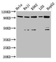Western Blot Positive WB detected in: Hela whole cell lysate, Raji whole cell lysate, K562 whole cell lysate, LO2 whole cell lysate, HepG2 whole cell lysate All lanes: PROM1 antibody at 4.8ug/ml Secondary Goat polyclonal to rabbit IgG at 1/50000 d...