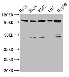 Western Blot Positive WB detected in: Hela whole cell lysate, Raji whole cell lysate, K562 whole cell lysate, LO2 whole cell lysate, HepG2 whole cell lysate All lanes: PROM1 antibody at 4.8ug/ml Secondary Goat polyclonal to rabbit IgG at 1/50000 d...