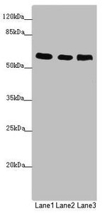 Western blot All lanes: PRPF4 antibody at 2.87µg/ml Lane 1: Jurkat whole cell lysate Lane 2: Hela whole cell lysate Lane 3: HepG2 whole cell lysate Secondary Goat polyclonal to rabbit IgG at 1/10000 dilution Predicted band size: 59 kDa Observed ba...