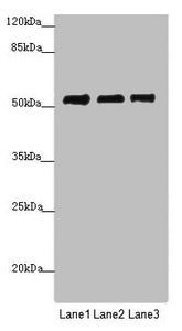Western blot All lanes: PRPF4 antibody at 3.89 ug/ml Lane 1: Jurkat whole cell lysate Lane 2: Hela whole cell lysate Lane 3: HepG2 whole cell lysate Secondary Goat polyclonal to rabbit IgG at 1/10000 dilution Predicted band size: 58 kDa Observed b...