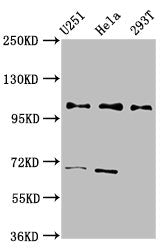 Western Blot Positive WB detected in: U251 whole cell lysate, Hela whole cell lysate, 293T whole cell lysate All lanes: PRPF40A antibody at 2.7ug/ml Secondary Goat polyclonal to rabbit IgG at 1/50000 dilution Predicted band size: 109, 106, 107, 11...