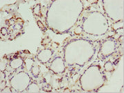 Immunohistochemistry of paraffin-embedded human thyroid tissue using CSB-PA018774ESR1HU at dilution of 1:100