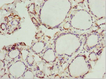 Immunohistochemistry of paraffin-embedded human thyroid tissue using CSB-PA018774ESR1HU at dilution of 1:100