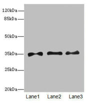 Western blot All lanes: PRPS1antibody at 6.28ug/ml Lane 1: HepG2 whole cell lysate Lane 2: Jurkat whole cell lysate Lane 3: 293T whole cell lysate Secondary Goat polyclonal to rabbit IgG at 1/10000 dilution Predicted band size: 35, 28 kDa Observed...