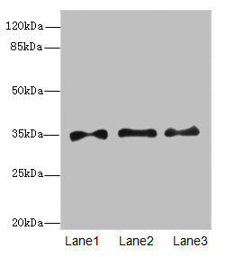 Western blot All lanes: PRPS1antibody at 6.28ug/ml Lane 1: HepG2 whole cell lysate Lane 2: Jurkat whole cell lysate Lane 3: 293T whole cell lysate Secondary Goat polyclonal to rabbit IgG at 1/10000 dilution Predicted band size: 35, 28 kDa Observed...