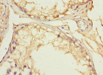 Immunohistochemistry of paraffin-embedded human testis tissue using CSB-PA018776ESR2HU at dilution of 1:100