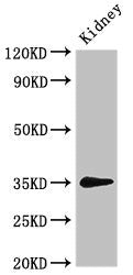 Western Blot Positive WB detected in: Rat kidney tissue All lanes: PRPS2 antibody at 3ug/ml Secondary Goat polyclonal to rabbit IgG at 1/50000 dilution Predicted band size: 35, 36 kDa Observed band size: 35 kDa