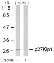 Western blot analysis of extracts from A2780 cells using p27Kip1(Ab-10