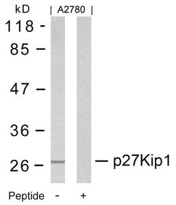 Western blot analysis of extracts from A2780 cells using p27Kip1(Ab-10