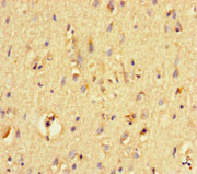 Immunohistochemistry of paraffin-embedded human brain tissue using CSB-PA018812LA01HU at dilution of 1:100