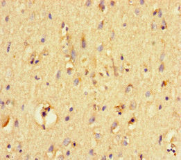 Immunohistochemistry of paraffin-embedded human brain tissue using CSB-PA018812LA01HU at dilution of 1:100