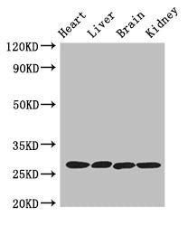 Western Blot Positive WB detected in: Mouse heart tissue, Mouse liver tissue, Mouse brain tissue, Mouse kidney tissue All lanes: PRSS2 antibody at 3ug/ml Secondary Goat polyclonal to rabbit IgG at 1/50000 dilution Predicted band size: 27 kDa Obser...