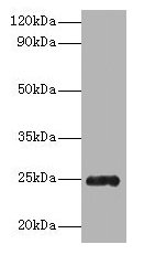 Western blot All lanes: Trypsin antibody at 2µg/ml + Recombinant Pig Trypsin protein 1µg Secondary Goat polyclonal to rabbit IgG at 1/10000 dilution Predicted band size: 25 kDa Observed band size: 25 kDa