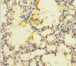 Immunohistochemistry of paraffin-embedded human lung tissue using CSB-PA018817LA01HU at dilution of 1:100
