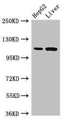 Western Blot Positive WB detected in: HepG2 whole cell lysate, Rat liver tissue All lanes: Tmprss15 antibody at 3ug/ml Secondary Goat polyclonal to rabbit IgG at 1/50000 dilution Predicted band size: 119 kDa Observed band size: 119 kDa