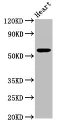 Western Blot Positive WB detected in: Mouse heart tissue All lanes: PSAP antibody at 3.3µg/ml Secondary Goat polyclonal to rabbit IgG at 1/50000 dilution Predicted band size: 59 kDa Observed band size: 59 kDa
