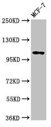 Western Blot Positive WB detected in: MCF-7 whole cell lysate All lanes: PSD antibody at 3.2µg/ml Secondary Goat polyclonal to rabbit IgG at 1/50000 dilution Predicted band size: 110, 71 kDa Observed band size: 110 kDa