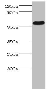 Western blot All lanes: PSEN1 antibody at 2µg/ml + Hela whole cell lysate Secondary Goat polyclonal to rabbit IgG at 1/10000 dilution Predicted band size: 53, 43, 22, 47, 49 kDa Observed band size: 53 kDa