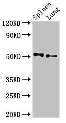 Western Blot Positive WB detected in: Rat spleen tissue, Rat lung tissue All lanes: PSEN2 antibody at 3ug/ml Secondary Goat polyclonal to rabbit IgG at 1/50000 dilution Predicted band size: 51, 47 kDa Observed band size: 51 kDa