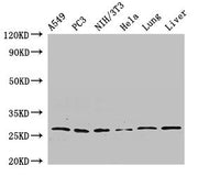 Western Blot Positive WB detected in: A549 whole cell lysate, PC-3 whole cell lysate, NIH/3T3 whole cell lysate, Hela whole cell lysate, Rat lung tissue, Mouse liver tissue All lanes: PSMA3 antibody at 2.7ug/ml Secondary Goat polyclonal to rabbit...