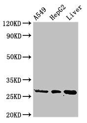 Western Blot Positive WB detected in: A549 whole cell lysate, HepG2 whole cell lysate, Rat liver tissue All lanes: PSMA5 antibody at 3ug/ml Secondary Goat polyclonal to rabbit IgG at 1/50000 dilution Predicted band size: 27, 21 kDa Observed band s...