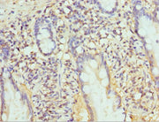 Immunohistochemistry of paraffin-embedded human small intestine tissue using CSB-PA018877ESR1HU at dilution of 1:100
