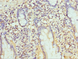 Immunohistochemistry of paraffin-embedded human small intestine tissue using CSB-PA018877ESR1HU at dilution of 1:100