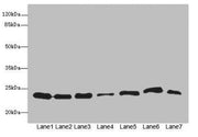 Western blot All lanes: PSMB3 antibody at 3.73µg/ml Lane 1: Hela whole cell lysate Lane 2: MCF-7 whole cell lysate Lane 3: HepG2 whole cell lysate Lane 4: K562 whole cell lysate Lane 5: Jurkat whole cell lysate Lane 6: NIH/3T3 whole cell lysate La...