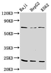 Western Blot Positive WB detected in: Raji whole cell lysate, HepG2 whole cell lysate, K562 whole cell lysate All lanes: PSMB9 antibody at 10µg/ml Secondary Goat polyclonal to rabbit IgG at 1/50000 dilution Predicted band size: 24, 23 kDa Observed...