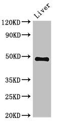 Western Blot Positive WB detected in: Mouse liver tissue All lanes: PSMC4 antibody at 3.4ug/ml Secondary Goat polyclonal to rabbit IgG at 1/50000 dilution Predicted band size: 48, 44 kDa Observed band size: 48 kDa