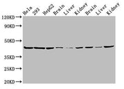 Western Blot Positive WB detected in: Hela whole cell lysate, 293 whole cell lysate, HepG2 whole cell lysate, Mouse brain tissue, Mouse liver tissue, Mouse kidney tissue, Rat brain tissue, Rat liver tissue, Rat kidney tissue All lanes: PSMC6 antib...