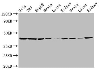 Western Blot Positive WB detected in: Hela whole cell lysate, 293 whole cell lysate, HepG2 whole cell lysate, Mouse brain tissue, Mouse liver tissue, Mouse kidney tissue, Rat brain tissue, Rat liver tissue, Rat kidney tissue All lanes: PSMC6 antib...