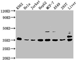 Western Blot Positive WB detected in: K562 whole cell lysate, Hela whole cell lysate, Jurkat whole cell lysate, HepG2 whole cell lysate, MCF-7 whole cell lysate, A549 whole cell lysate, 293T whole cell lysate, Rat liver tissue All lanes: PSMD14 an...