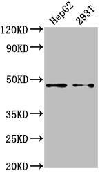 Western Blot Positive WB detected in: HepG2 whole cell lysate, 293T whole cell lysate All lanes: PSMD4 antibody at 1:2000 Secondary Goat polyclonal to rabbit IgG at 1/50000 dilution Predicted band size: 41, 29 kDa Observed band size: 41 kDa