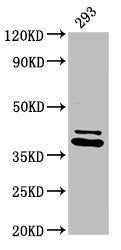 Western Blot Positive WB detected in: 293 whole cell lysate All lanes: PSMD7 antibody at 3.2ug/ml Secondary Goat polyclonal to rabbit IgG at 1/50000 dilution Predicted band size: 38 kDa Observed band size: 38 kDa