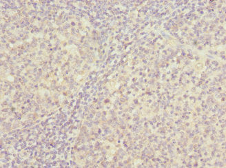 Immunohistochemistry of paraffin-embedded human tonsil tissue using CSB-PA018913ESR2HU at dilution of 1:100