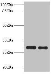 Western blot All lanes: PSME1 antibody at 0.75µg/ml Lane 1: Mouse liver tissue Lane 2: Raji whole cell lysate Secondary Goat polyclonal to rabbit IgG at 1/10000 dilution Predicted band size: 29, 27 kDa Observed band size: 29 kDa