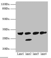 Western blot All lanes: PSME1 antibody at 1.4ug/ml Lane 1: Mouse liver tissue Lane 2: Mouse thymus tissue Lane 3: Raji whole cell lysate Lane 4: HL60 whole cell lysate Secondary Goat polyclonal to rabbit IgG at 1/10000 dilution Predicted band size...