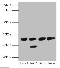 Western blot All lanes: PSME1 antibody at 1.4ug/ml Lane 1: Mouse liver tissue Lane 2: Mouse thymus tissue Lane 3: Raji whole cell lysate Lane 4: HL60 whole cell lysate Secondary Goat polyclonal to rabbit IgG at 1/10000 dilution Predicted band size...