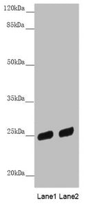 Western blot All lanes: PSPH antibody at 3.81µg/ml Lane 1: HL60 whole cell lysate Lane 2: A431 whole cell lysate Secondary Goat polyclonal to rabbit IgG at 1/10000 dilution Predicted band size: 25 kDa Observed band size: 25 kDa