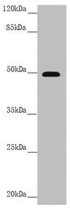 Western blot All lanes: PSTPIP1 antibody at 3.99 ug/ml + Raw264.7 whole cell lysate Secondary Goat polyclonal to rabbit IgG at 1/10000 dilution Predicted band size: 48, 46 kDa Observed band size: 48 kDa