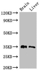 Western Blot Positive WB detected in: Mouse brain tissue, Rat liver tissue All lanes: PTF1A antibody at 2.7ug/ml Secondary Goat polyclonal to rabbit IgG at 1/50000 dilution Predicted band size: 35 kDa Observed band size: 35 kDa