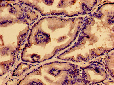 Immunohistochemistry of paraffin-embedded human prostate tissue using CSB-PA018969HA01HU at dilution of 1:100