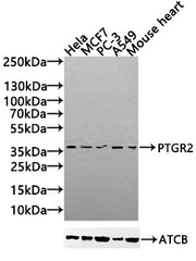 Western Blot Positive WB detected in: Hela whole cell lysate(30µg), MCF7 whole cell lysate(30µg), PC-3 whole cell lysate(30µg), A549 whole cell lysate(20µg),Mouse Heart tissue lysate(30µg) All lanes:PTGR2 antibody at 1:1000 Secondary Goat polyclon...